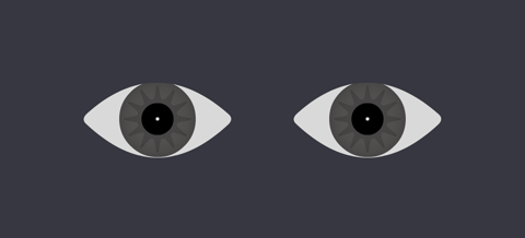 Duane Syndrome (Type 1)